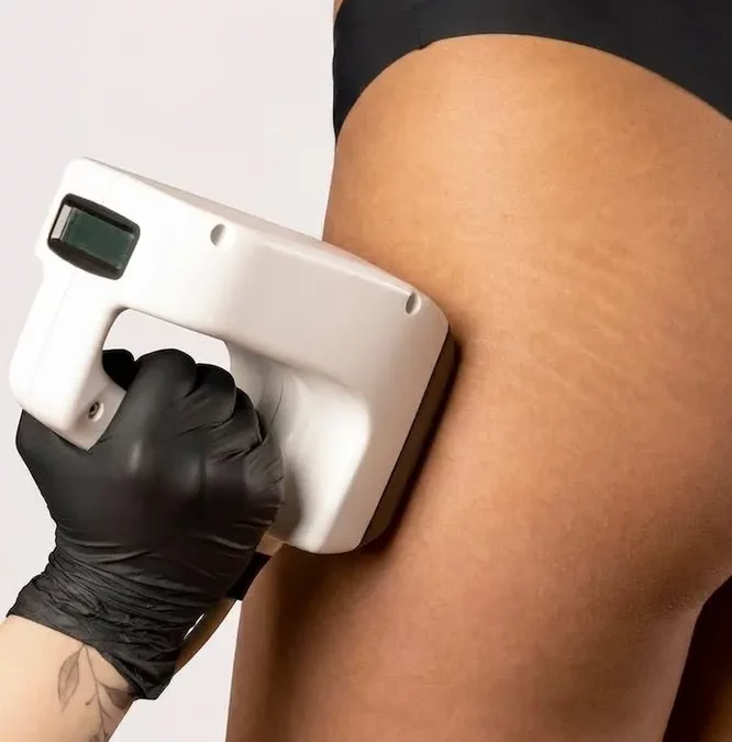 BODY FAT LOSS