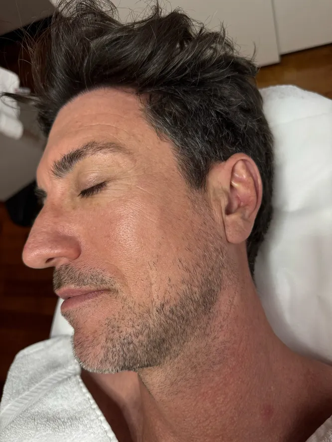 tired-aging-sking-after