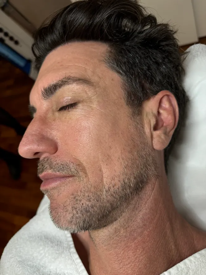 tired-aging-sking-before