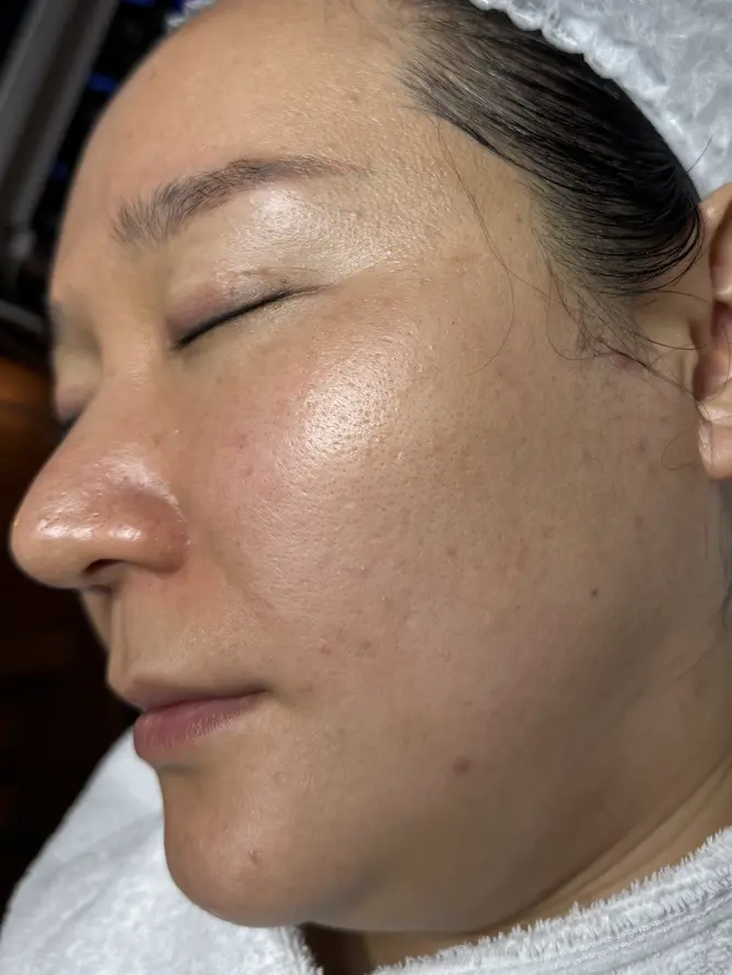 anti-aging-after